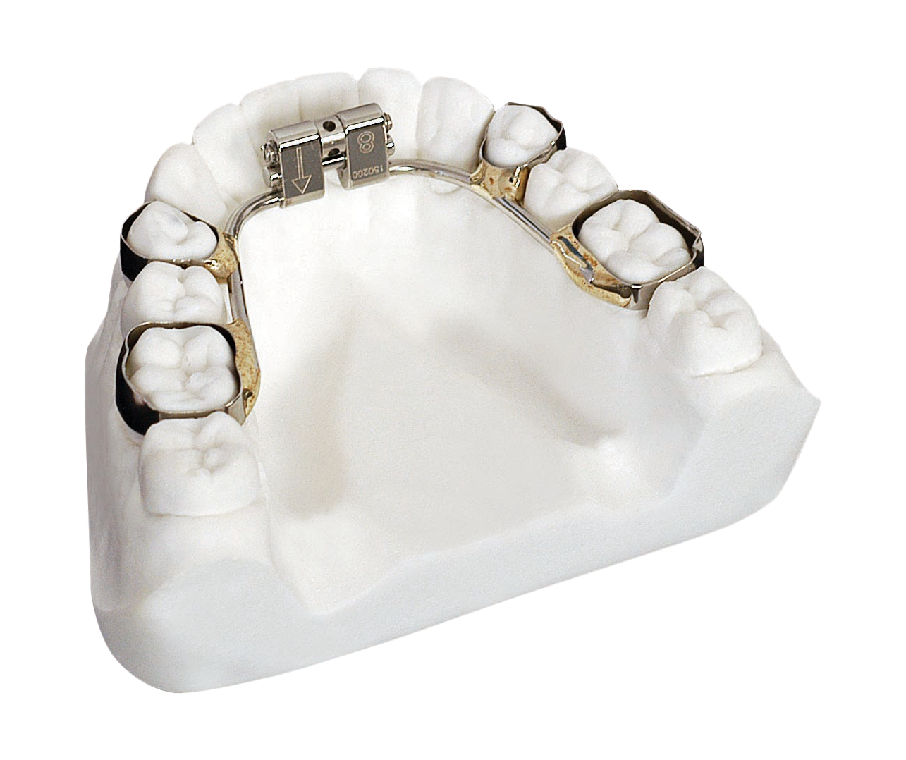 Ortodontik Apereyler